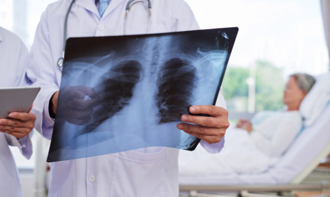 Ηλεκτρονικό τσιγάρο: 5 νεκροί, 450 στα νοσοκομεία – Τα ύποπτα συμπτώματα - Paterakis Medical Group