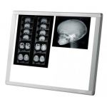 Διαφανοσκόπιο MIMSAL AF 200 LED SLIM | Διαφανοσκόπια στο Paterakis Medical Group