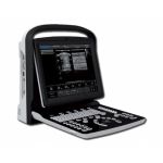 Ασπρόμαυρος Φορητός Υπέρηχος Chison ECO1 με 2 Θύρες | Υπερηχογράφοι στο Paterakis Medical Group