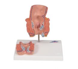 Πρόπλασμα Αιμορροΐδων | Προπλάσματα - Αφίσες στο Paterakis Medical Group