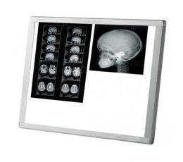 Διαφανοσκόπιο MIMSAL AF 200 LED SLIM | Διαφανοσκόπια στο Paterakis Medical Group