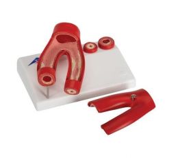 Πρόπλασμα Αρτηριοσκλήρυνσης | Προπλάσματα - Αφίσες στο Paterakis Medical Group