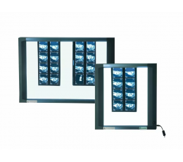 Διαφανοσκόπιο LED Slim Fazzini | Διαφανοσκόπια στο Paterakis Medical Group