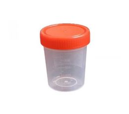 Δοχείο δειγματοληψίας ούρων 1τεμ 120ml | Μικροβιολογικά Εργαλεία - Αναλώσιμα στο Paterakis Medical Group