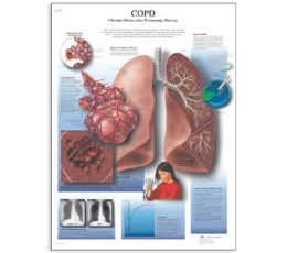 Εκπαιδευτική Αφίσα Χ.Α.Π | Προπλάσματα - Αφίσες στο Paterakis Medical Group