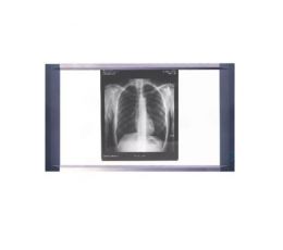 Διαφανοσκοπιο διπλό LED LCD | Διαφανοσκόπια στο Paterakis Medical Group