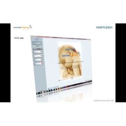 Λογισμικό Ανάλυσης & Απεικόνισης Καρδιοτοκογράφων FetalCare3 Huntleigh | Καρδιοτοκογράφοι στο Paterakis Medical Group