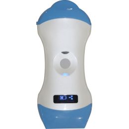 Ασύρματος Διαγνωστικός Υπέρηχος Microconvex 3.5/5.0MHz & Linear 7.5/10.0MHz Sonostar | Υπερηχογράφοι στο Paterakis Medical Group