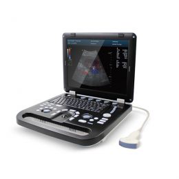 Έγχρωμος Φορητός Υπέρηχος Doppler CONTEC CMS1700C | Convex Array Probe 3.5MHz | Υπερηχογράφοι στο Paterakis Medical Group