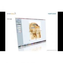 FetalCare3 Software Καρδιοτοκογράφων Huntleigh | Καρδιοτοκογράφοι στο Paterakis Medical Group
