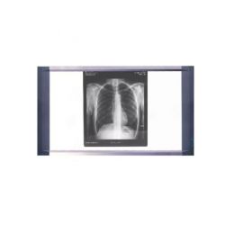 Διαφανοσκοπιο διπλό LED LCD | Διαφανοσκόπια στο Paterakis Medical Group