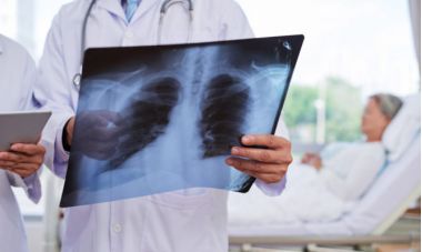 Ηλεκτρονικό τσιγάρο: 5 νεκροί, 450 στα νοσοκομεία – Τα ύποπτα συμπτώματα - Paterakis Medical Group