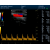 Έγχρωμος Φορητός Υπέρηχος Doppler CONTEC CMS1700C | Convex Array Probe 3.5MHz | Υπερηχογράφοι στο Paterakis Medical Group